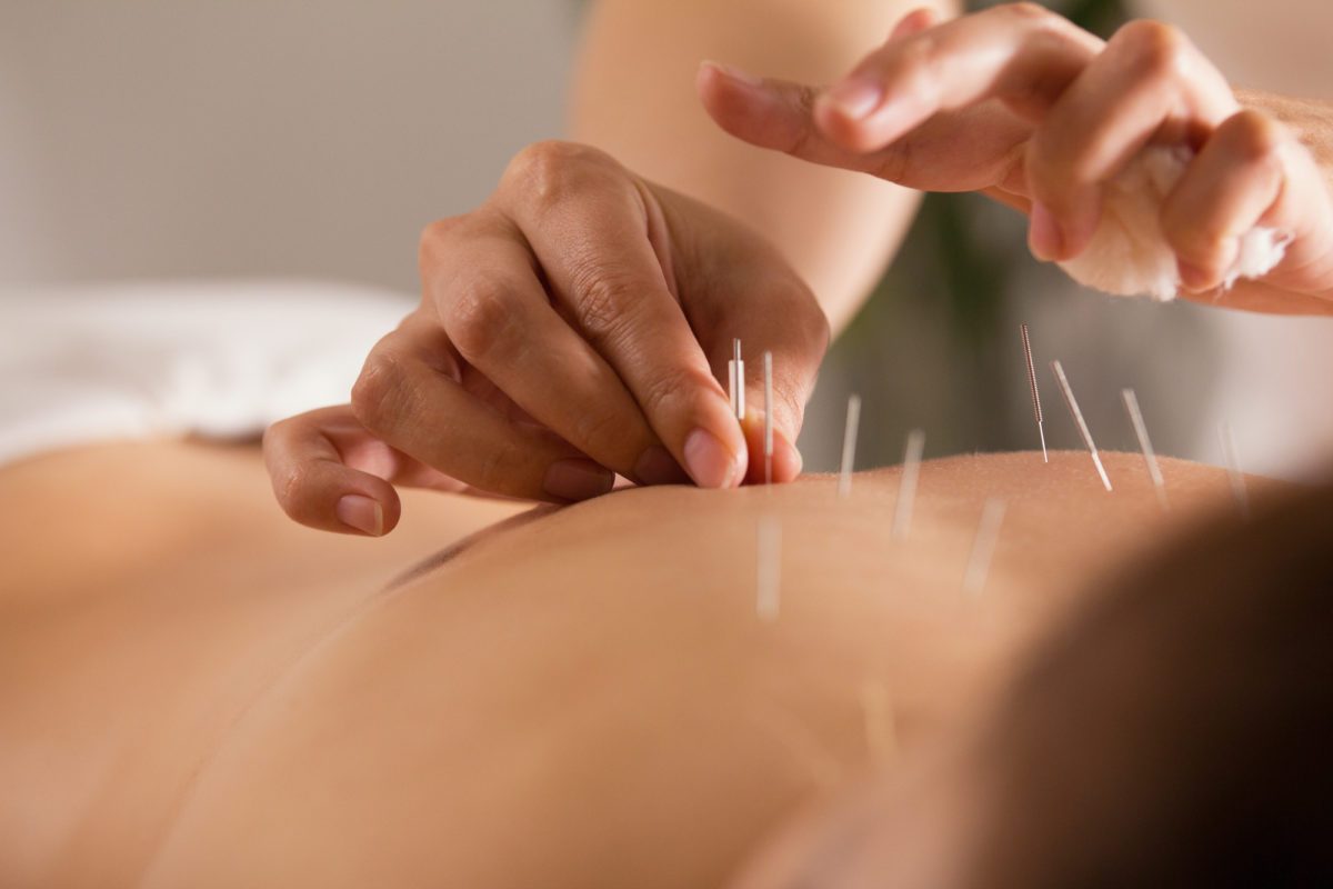 Conditions Treated By Acupuncture