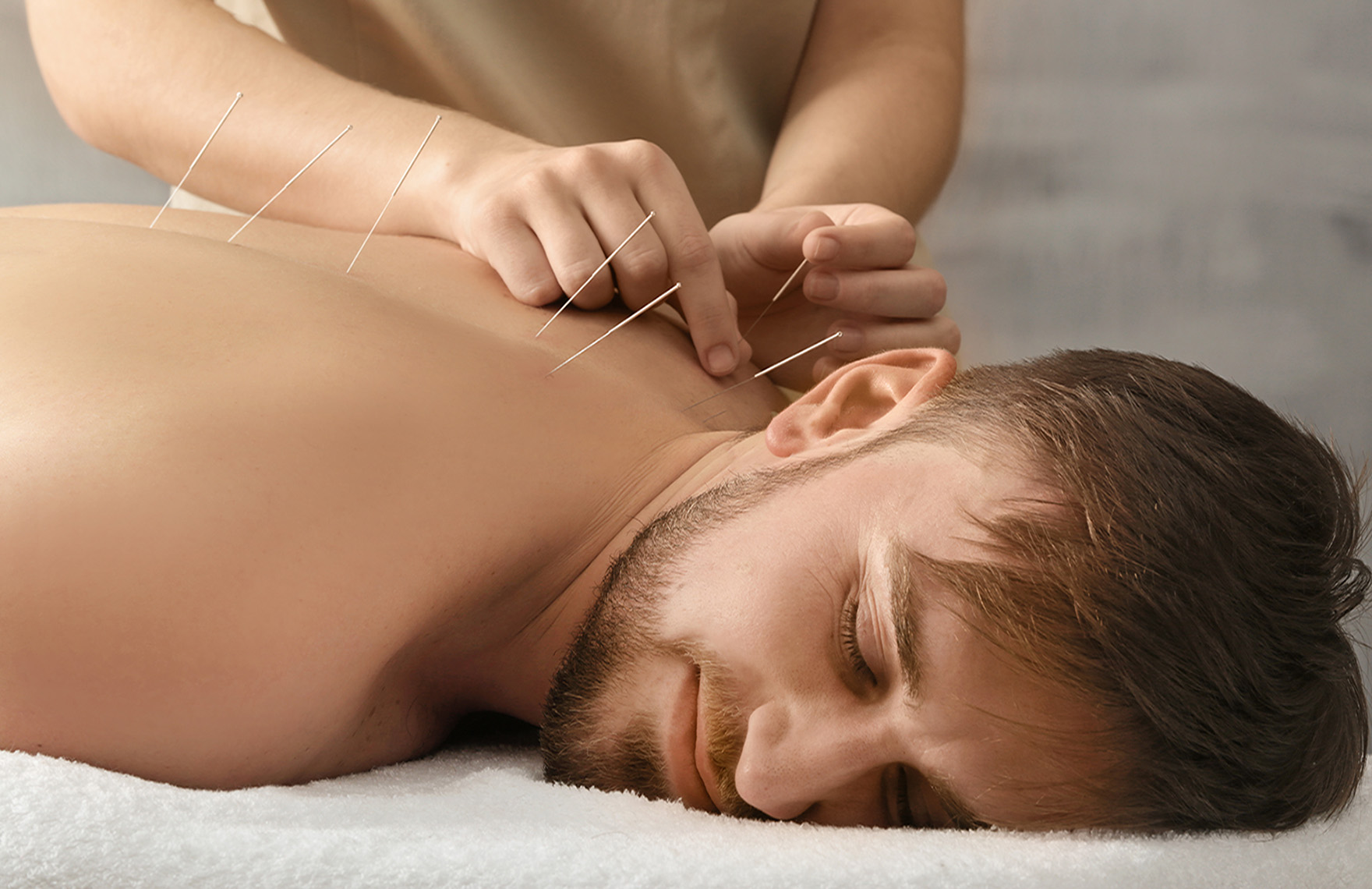 Acupuncture Therapy in Westchester