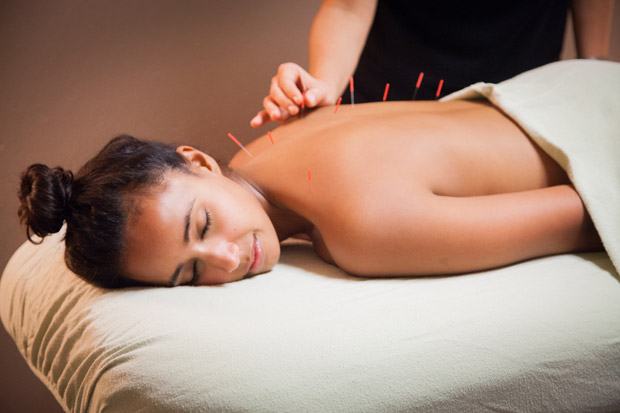 Acupuncture Therapy For Pain in LAX