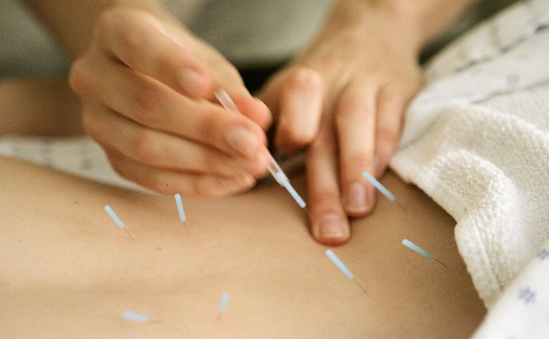 10 Ways to Get the Most from Your Acupuncture Treatment