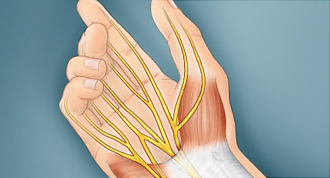 carpal tunnel relief