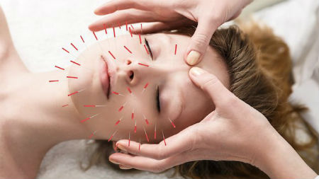 Acupuncture for Depression: Does It Really Work?