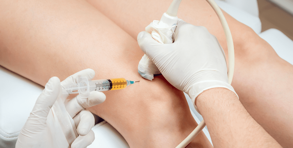 PRP vs Corticosteroid Injections For Joint Pain