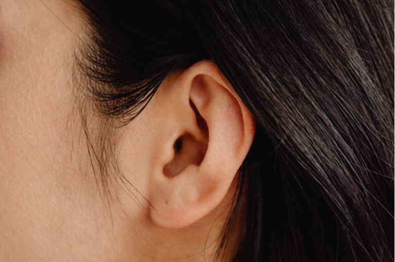 How Acupuncture Can Keep Your Tinnitus at Bay